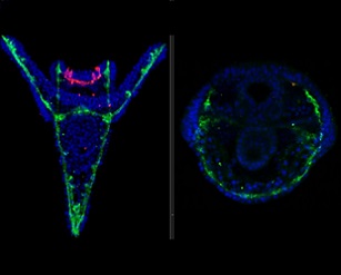 The skeleton (green) and nervous system (magenta) of sea urchin larvae are affected by chemicals from microplastics. Left - not treated. Right - treated. Credit: Periklis Paganos