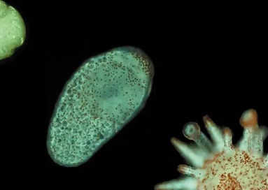 This photo shows a developing sea urchin, from egg (top left) to larva, to a metamorphosed (matured into adult form) individual. Dustin Marshall, Author provided
