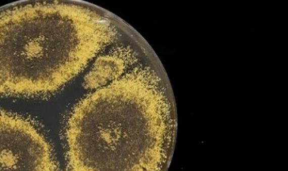 A culture of Eurotium herbariorum fungus, often retrieved from ocean-floor sediments.Credit: Tom Kleindinst/Woods Hole Oceanographic Institution (WHOI)