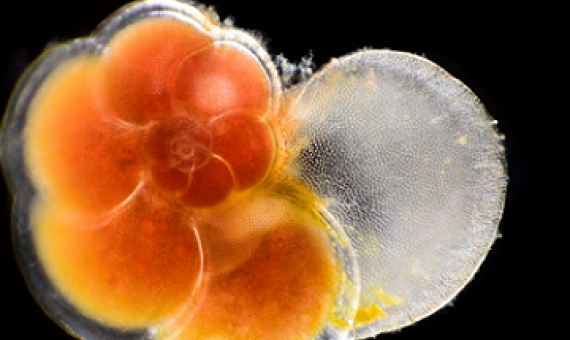 A foram, or member of the plankton group foraminifera, is a single-celled marine animal that lives inside a protective chalky shell. Photo credit - Solvin Zankl Photography
