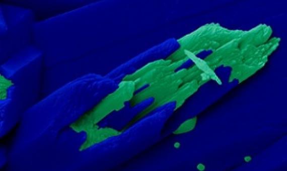 A high-power microscopic image of the skeleton from Turbinaria peltata. Credit: Pupa Gilbert