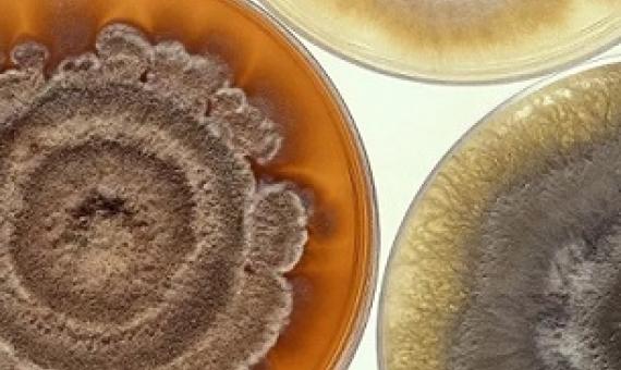 Scientists Find Bacteria so Alien to Human Immune System It Can’t Detect It. Credit - CC0